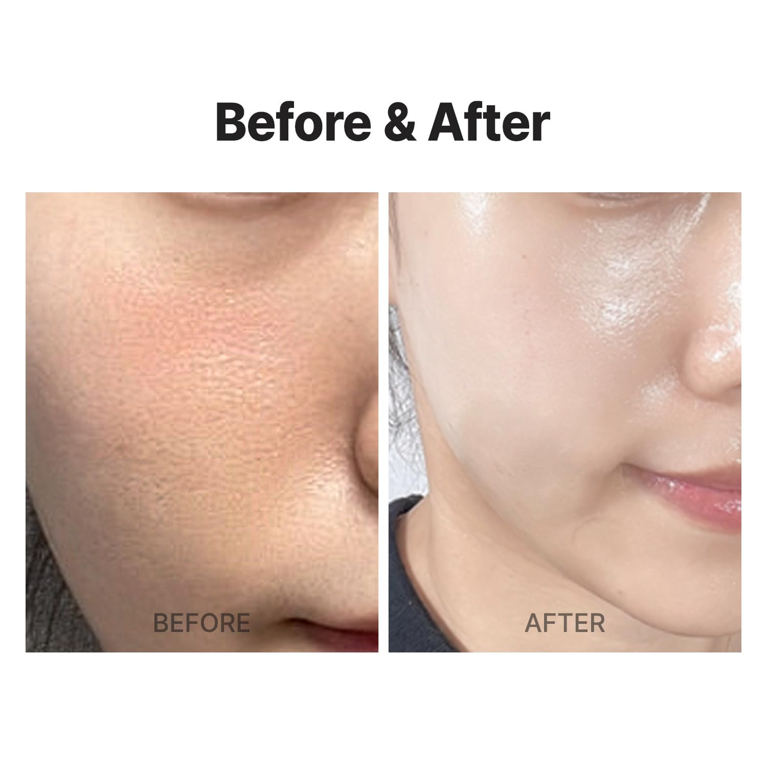 Meditherapy Wrinkle Fit Mesh Sheet Masks + Boosting Roller (Mask 7Ea + Roller 1Ea), Collagen Mask,Quick Absorption With Roller,