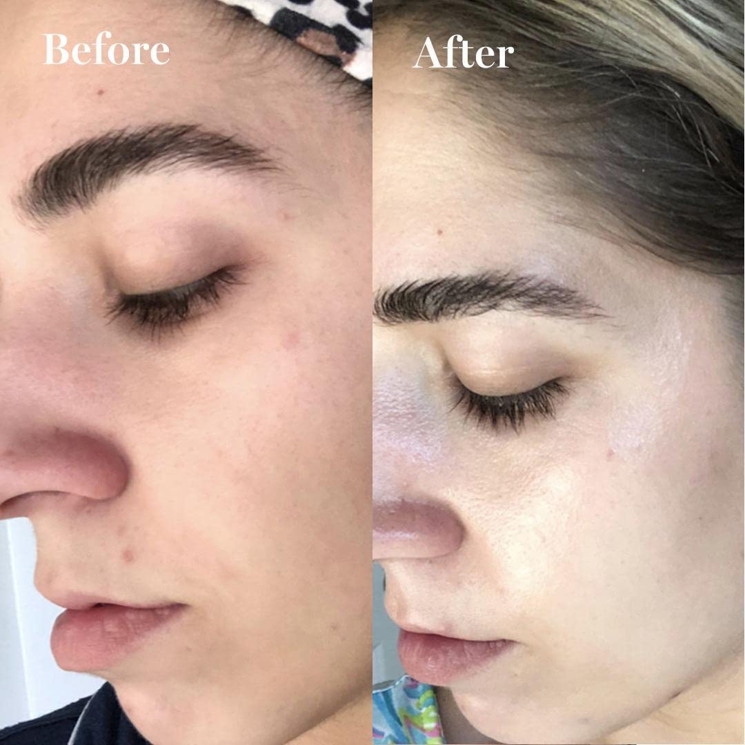 Saturday Skin Face Moisturizing Cream with Carrot, Niacinamide, Ceramides & Centella Asiatica, Peptide, Paraben-Free, Sulfates-F
