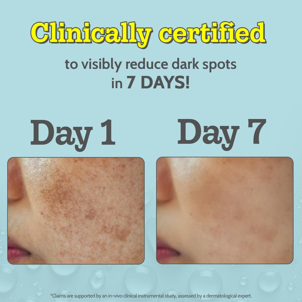 Chemist At Play 10% Vitamin C Face Serum |Brightens & Gives Glow |Fades Dark Spots |Treats Hyperpigmentation| Balances Melanin P