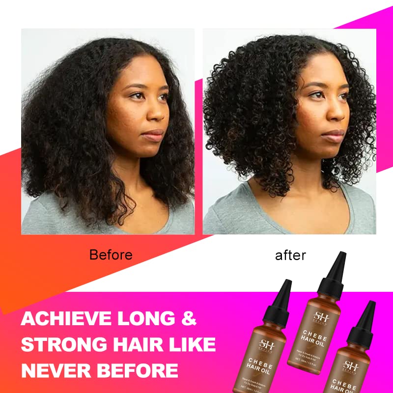 100% Naturals Chebe Hair Oil - Sevich African Chebe Powder Serum, Hair Loss Treatments Repair Damaged Moisture Hair Regrowth Tre