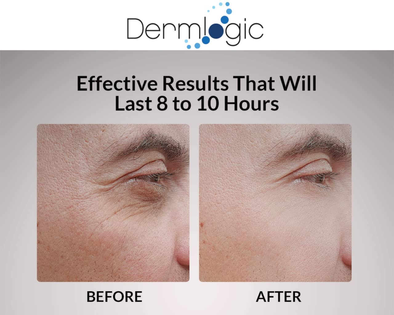 Under Eye Puffiness & Dark Circles Rapid Treatment- Instantly Reduces The Appearance Of Puffy Eye Bags, Crows Feet, & Sagging Sk