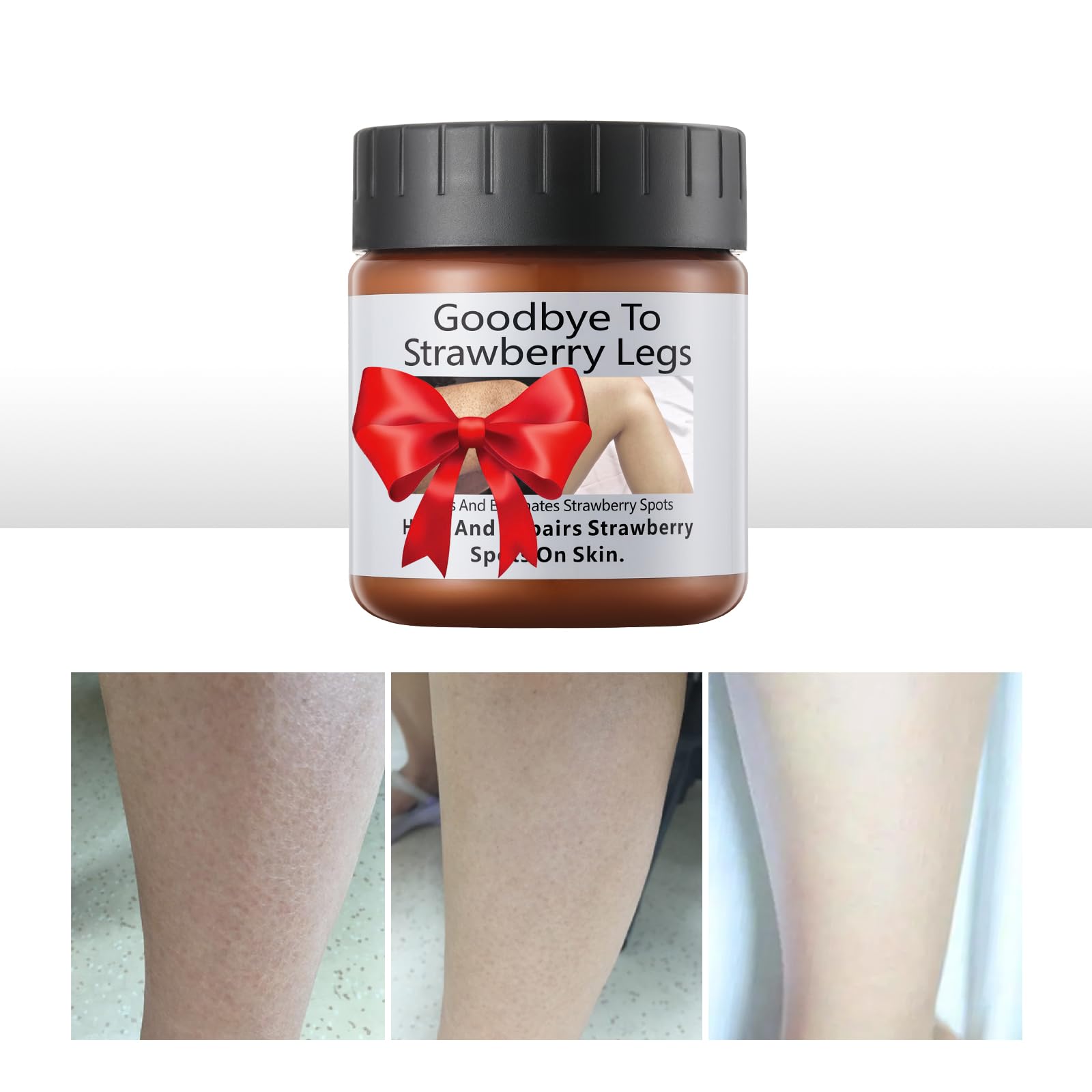 Strawberry Legs Treatment Cream For Women Keratosis Pilaris Lotion Chicken Skin Treatment Moisturizing Strawberry Skin Smooth Ra