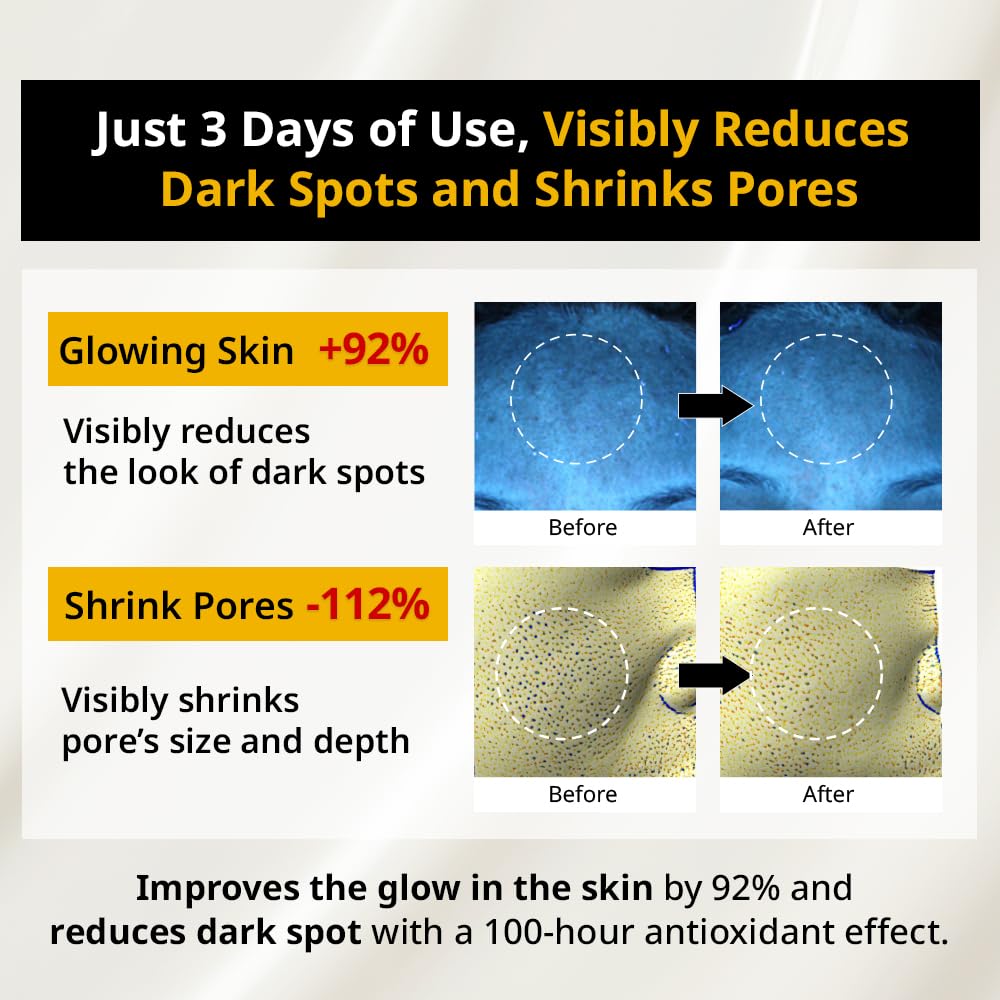 Primera (Prmr) Youth Radiance Vitatinol Serum - Retinol With Vitamin Bundle Set Vitamin A, C, Skin Care, Moisturizing, Shiny, El