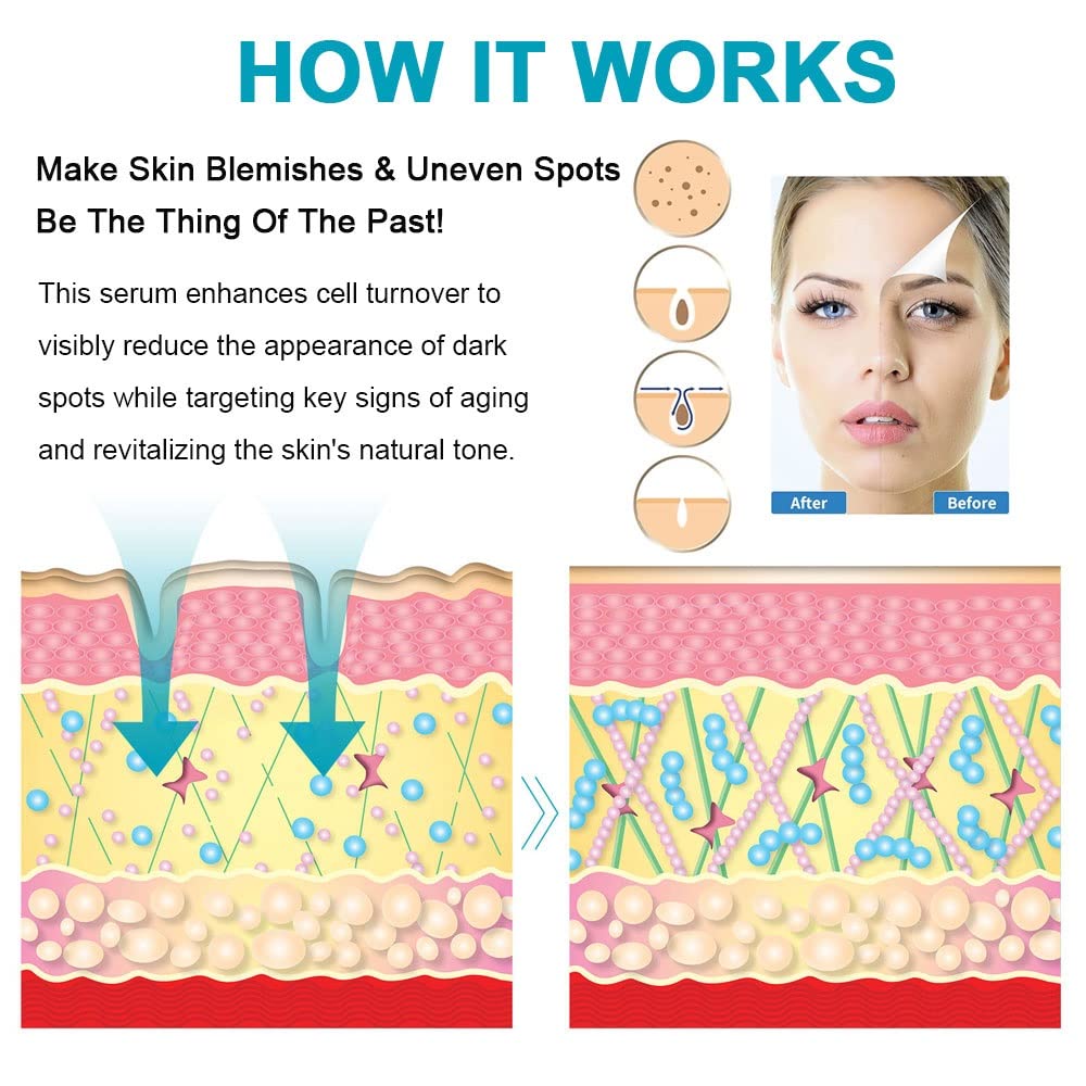 Swetiyou Dark Spot Remover For Face, Fast-Acting Dark Spot Corrector Remover For Face And Body Hyperpigmentation, Fades Melasma,