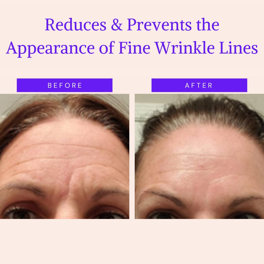 Blumbody Face & Forehead Wrinkle Patches - Anti Wrinkle Facial Patches To Smooth Eye, Mouth, Forehead Wrinkles - Non-Silicone Fa