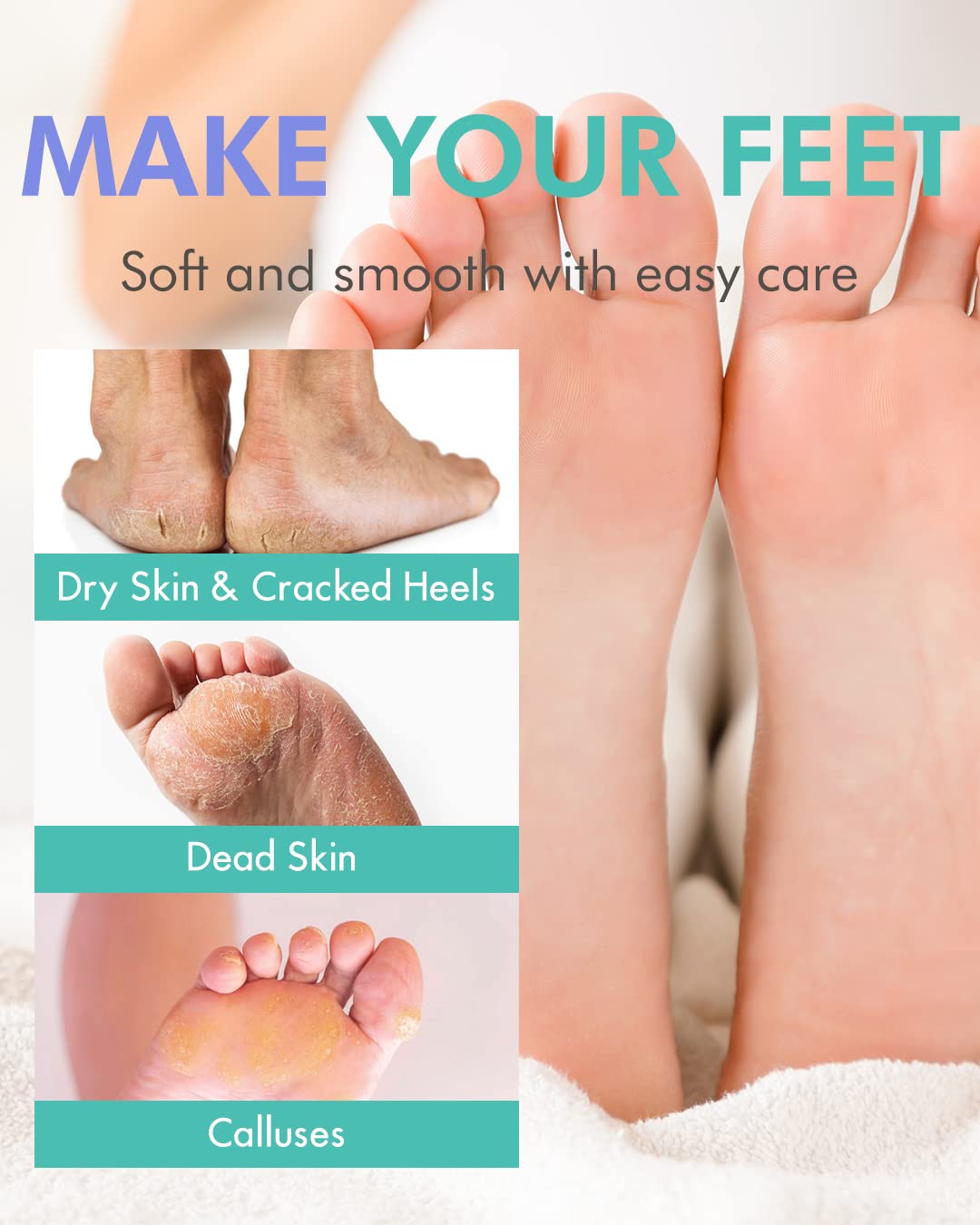 Dermal Korea Foot Peeling Mask 2 Pack For Dry Foot And Cracked Heel & Callus With Aloe Vera And Collagen - Exfoliating Peel Mask