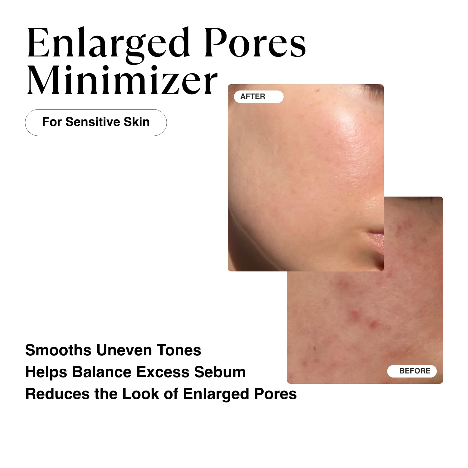 Matkas Korean Niacinamide Serum For Face Antioxidant Ampoule - For Excess Oil, Large Pores, Uneven Skin Tone, Dullness - Centell