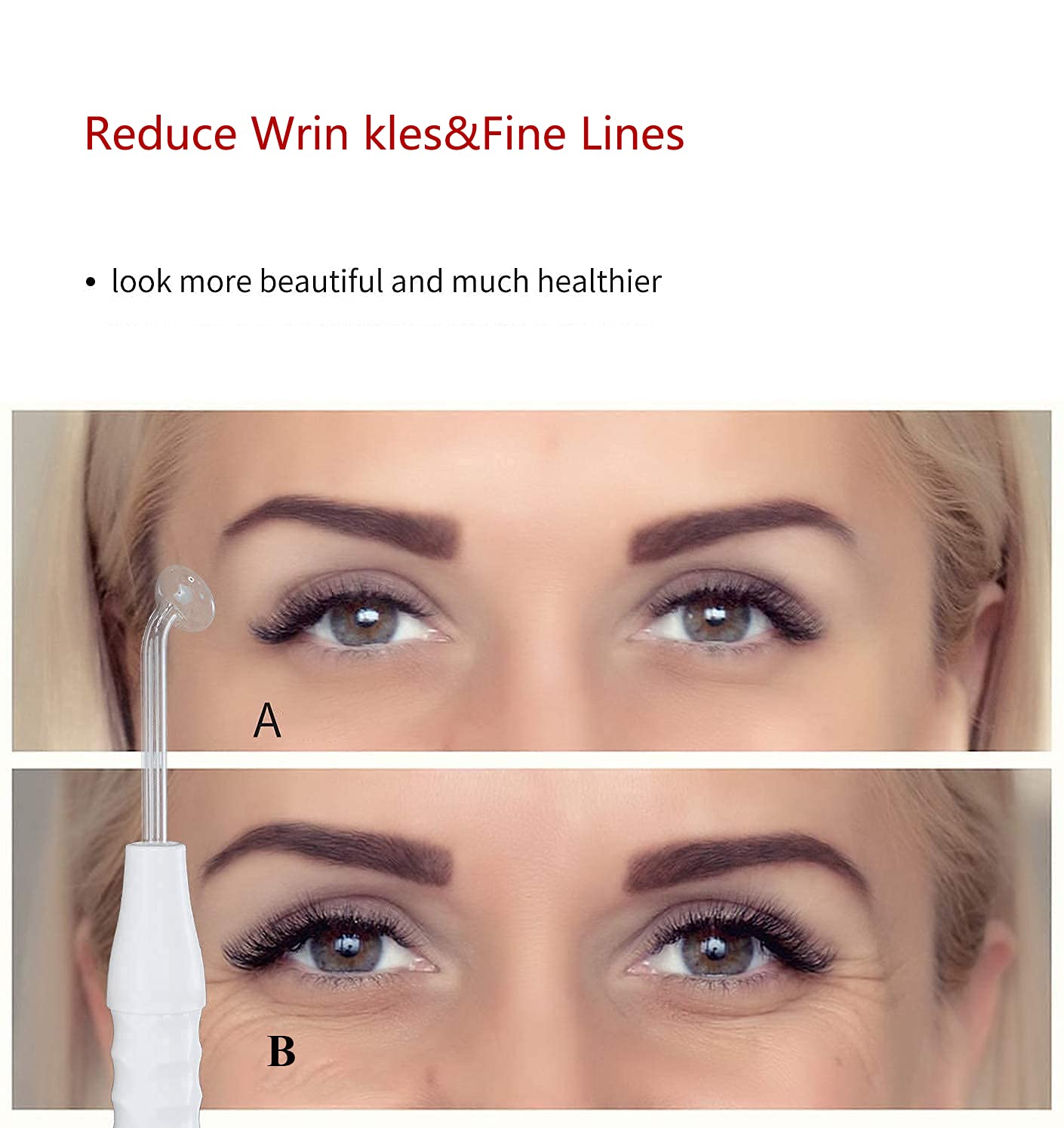 High Frequency Facial Wand/Machine With 5 Argon Parts Skin Care Tool For Wrinkles Reducing Face Skin Tightening.