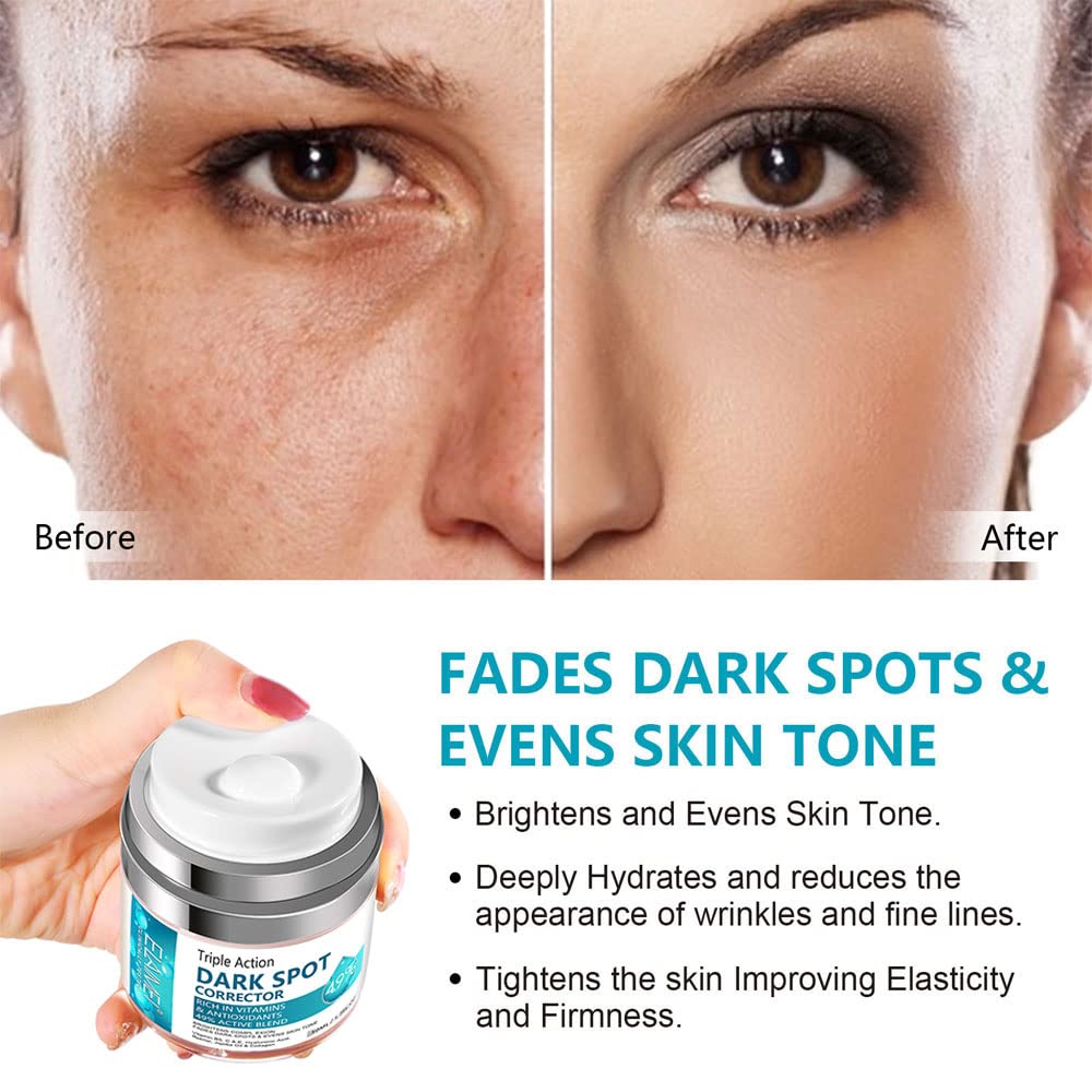 Swetiyou Dark Spot Remover For Face, Fast-Acting Dark Spot Corrector Remover For Face And Body Hyperpigmentation, Fades Melasma,