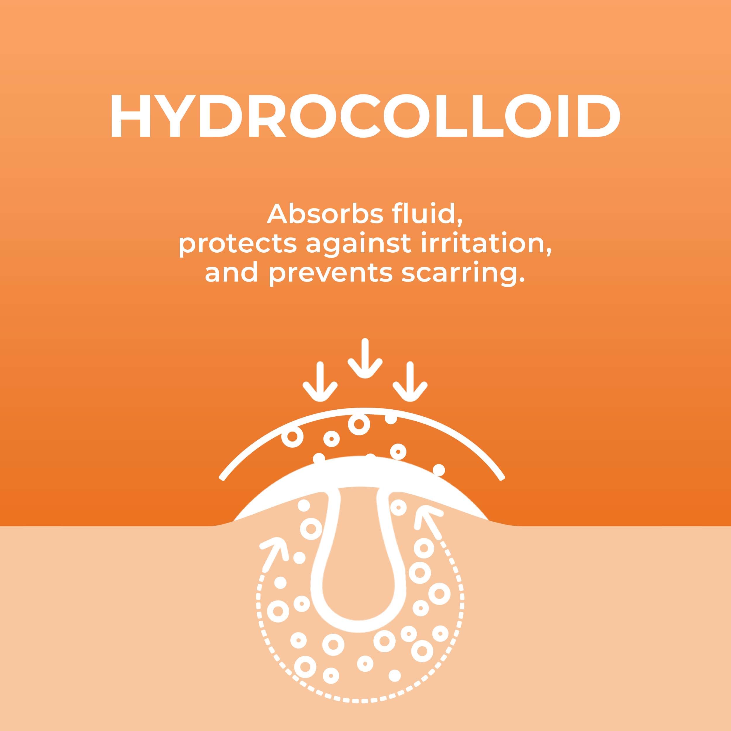 Patchrx Acne Patches (120 Count) With Hydrocolloid Only, Hydrocolloid Pimple Patches For Face - Zit Patch Acne Dots - Acne Patch