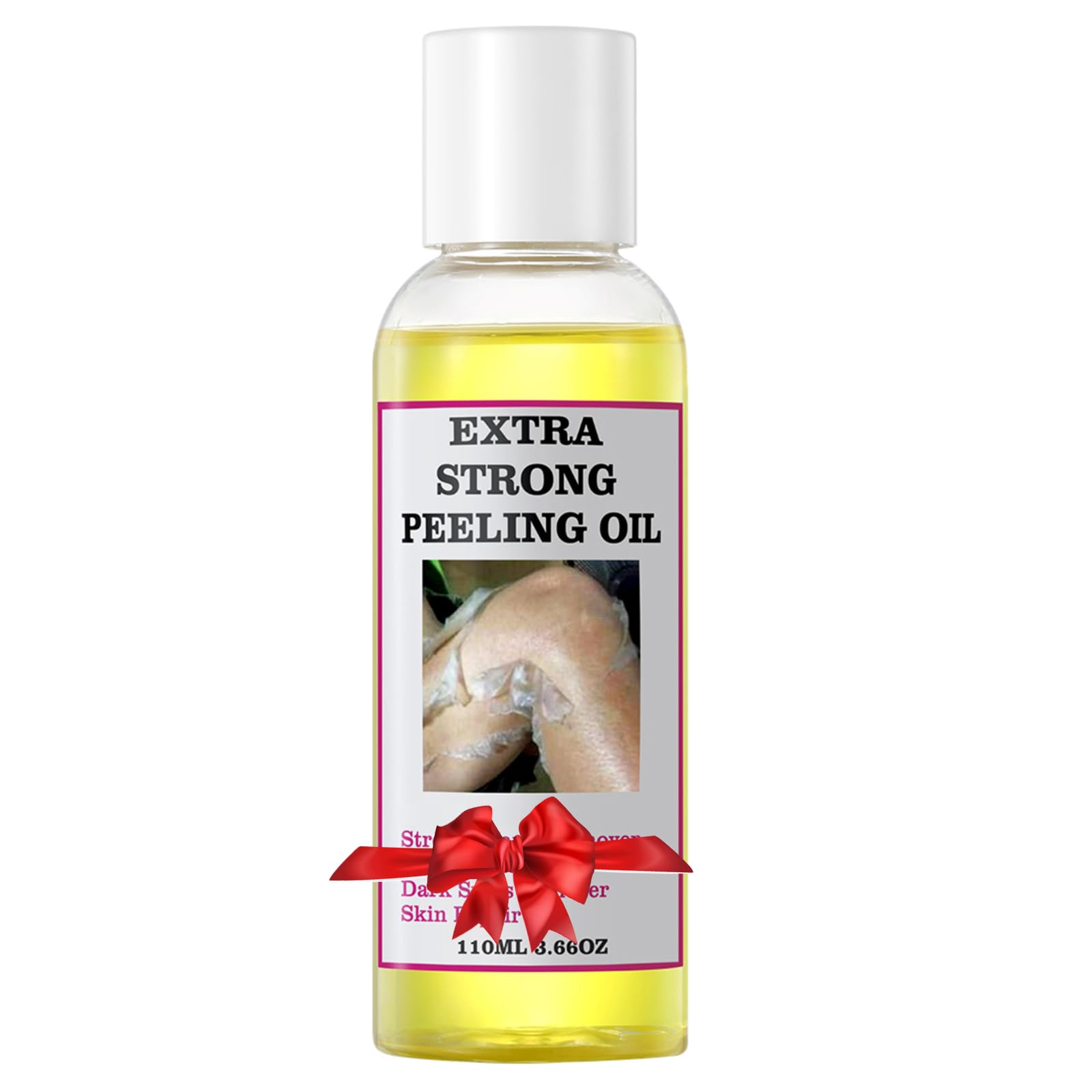 Peeling Oil For Dark Skin, Yellow Peeling Oil, Strong Peeling Oil Extra Strength, Exfoliating Peeling Solution For Body All Skin