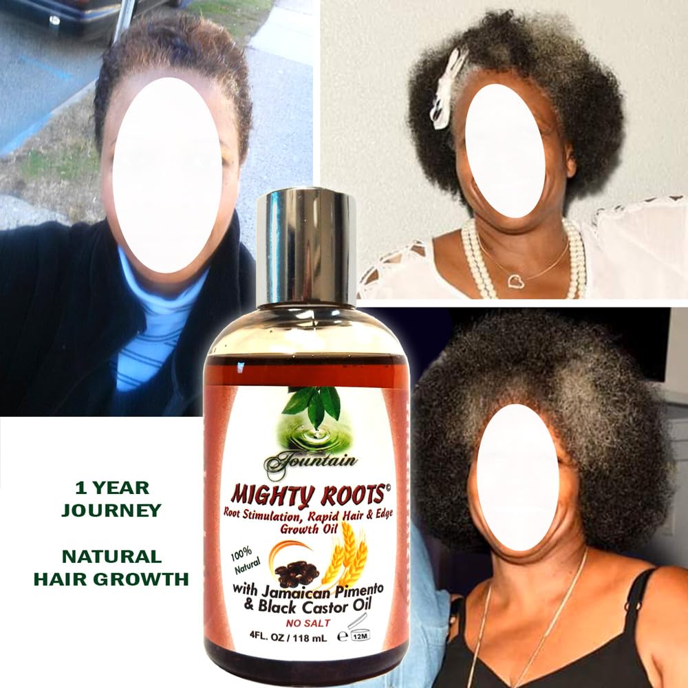 FOUNTAIN Mighty Roots - Damaged - Receding - Edges - Bald Spot - Thinning Hair Oil - Applicator Bottle - 4 Fl Oz