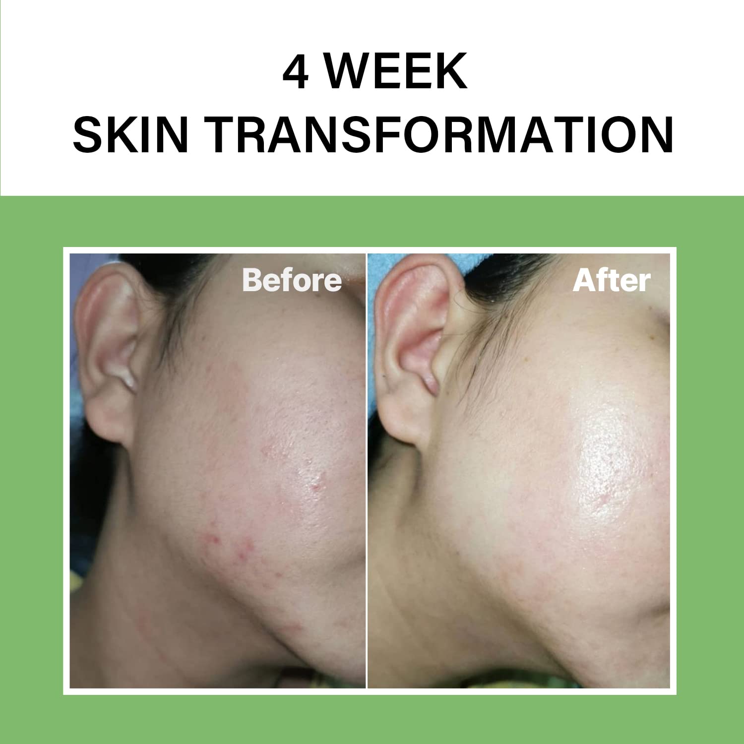 celimax Noni Energy Ampoule 30ml | with 71.77% Noni Extract, Hydrating, Moisturizing & Soothing Serum for Wrinkles & Fine Lines,