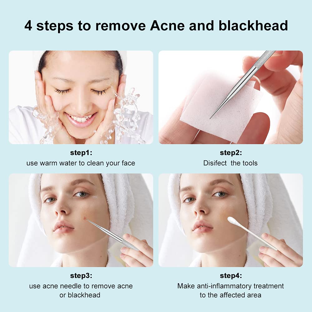 La Chat Blackhead Remover Tool Set - 2 PCS Stainless Steel Pimple Extractor, Risk-Free Treatment for Blemishes, Black