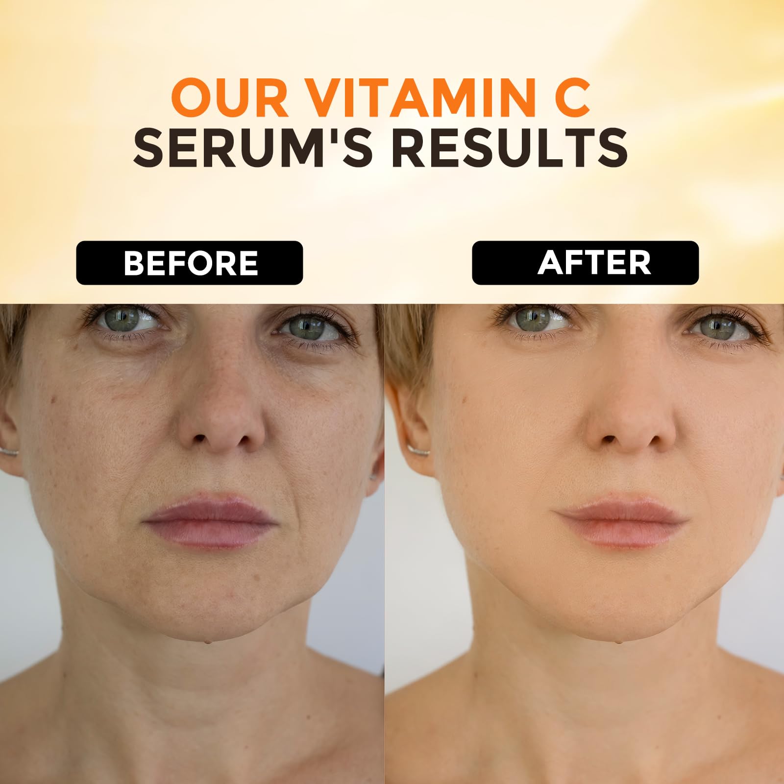 +1Herolabs 2 Packs Vitamin C Serum For Face -Anti Aging Face & Eye Serum, Hyaluronic Acid, Reduce Fine Lines, Dark Spots And Wri