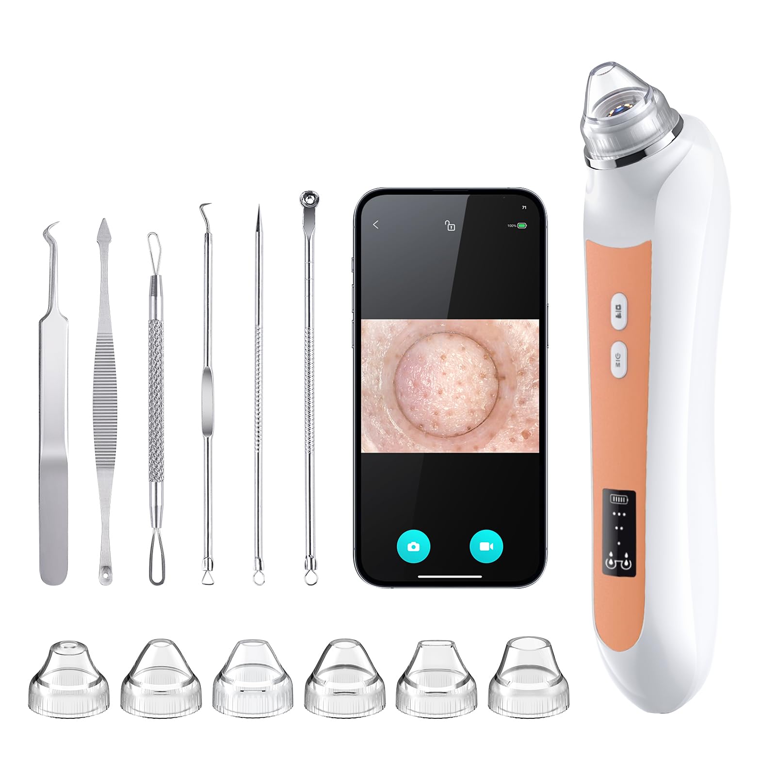 Facial Pore Blackhead Remover Vacuum, 1080P Camera Blackhead Remover, 20x Zoom, 8 LEDs & 3 Suction Modes, 800mAh Battery & USB -