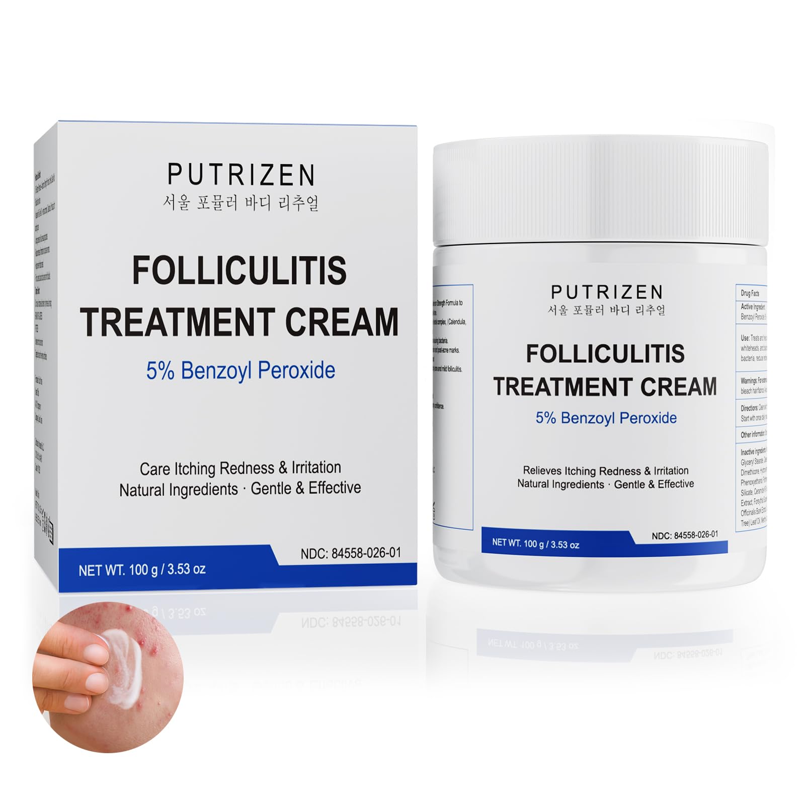 PUTRIZEN Folliculitis Treatment Cream  5% Benzoyl Peroxide