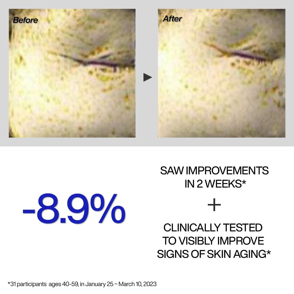 Iope Retinol Expert 0.1% - Anti-Aging Serum With Pure Retinol, Reduce Wrinkles & Fine Lines, Pore Refining, Ideal For Retinol-Ex