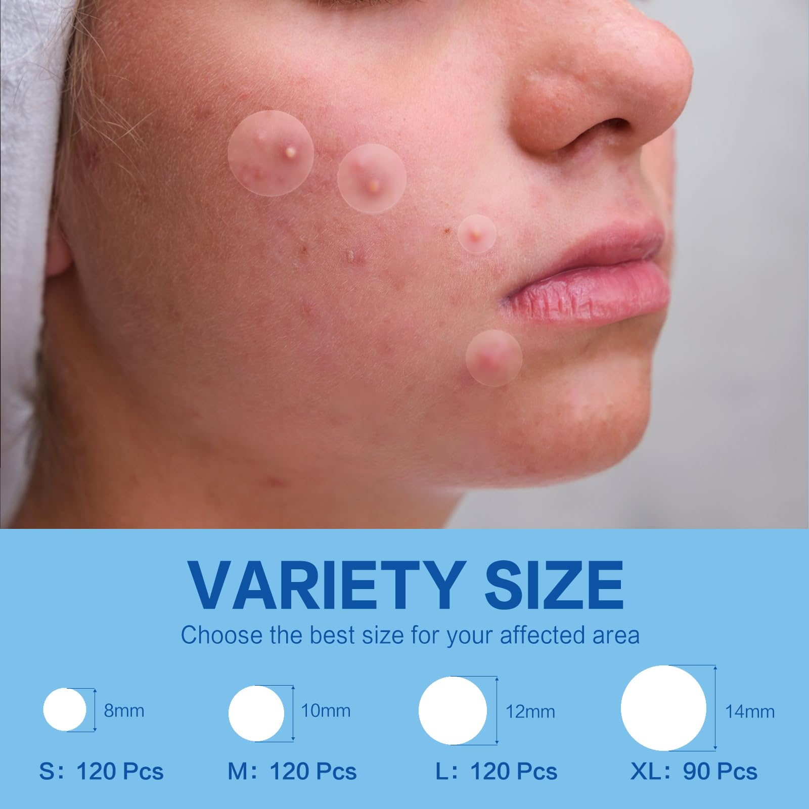450 Pimple Patches For Face, Hydrocolloid Acne Patches For Zit Covers, Invisible Skin Stickers For Blemish Spot Treatment, 4 Siz