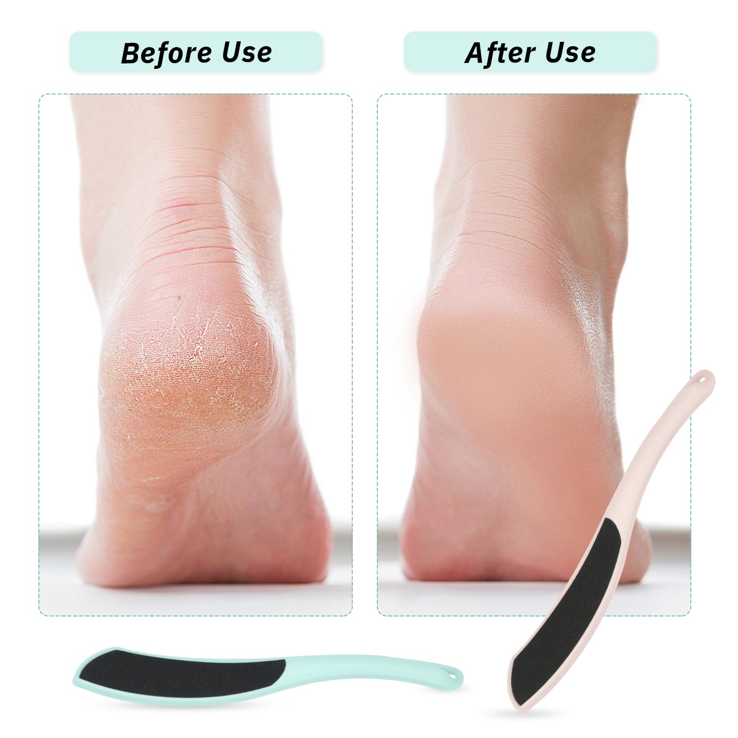 12 Pcs Foot File Double Sided Foot Scraper Dead Skin Foot Rasp Callus Remover Pedicure Tools for Foot Scrubber Files Kit Heel Sc