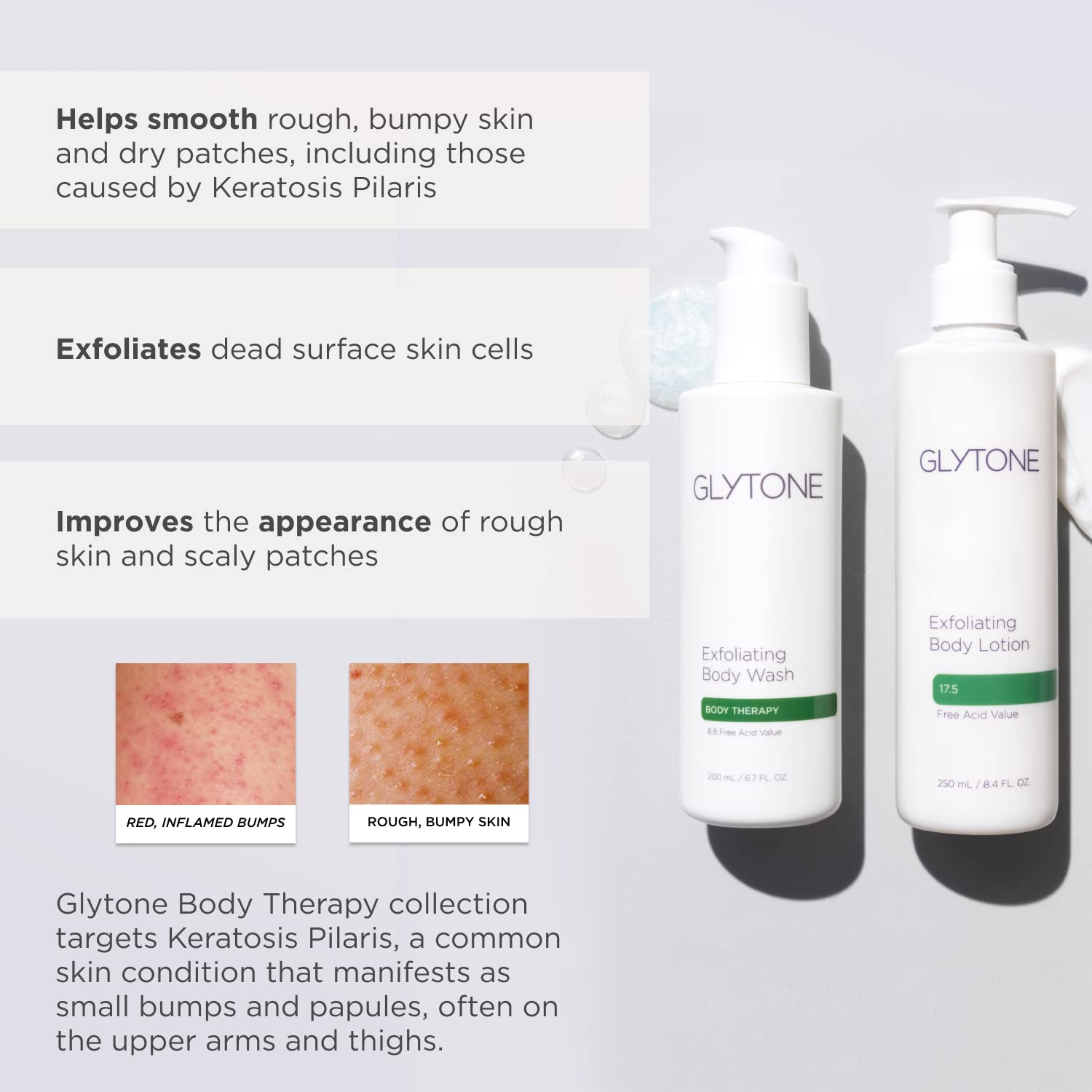 Glytone Glycolic Acid Exfoliating Body Lotion, Keratosis Pilaris Lotion For Rough And Bumpy Skin, Dry Skin Lotion, 17.5% PFAV Gl