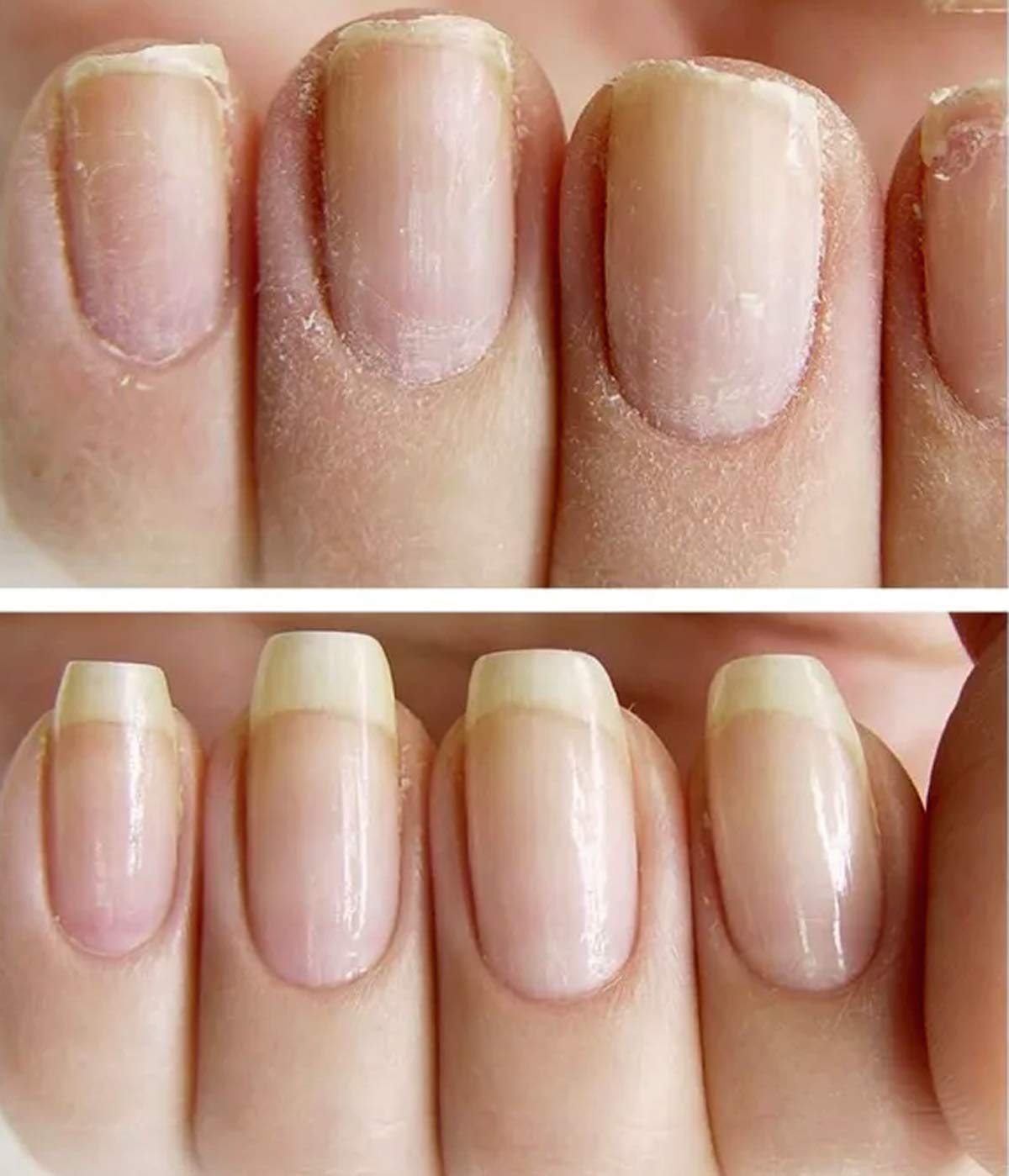 NAILVIVE Nail Serum Powerful Magic-like Silk Proteins Proven Natural Formula Strengthening Hardening nails Instantly Prevents Sp