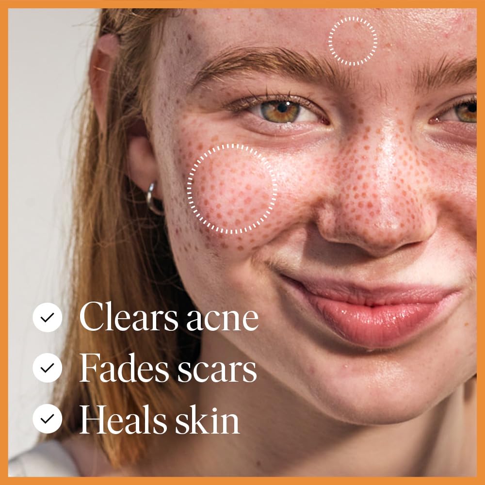 47 Skin Hydrating Face Serum for clearing Acne and Scars, Anti-Blemish & Scar Repair Serum Skincare Treatment with Silver chitod