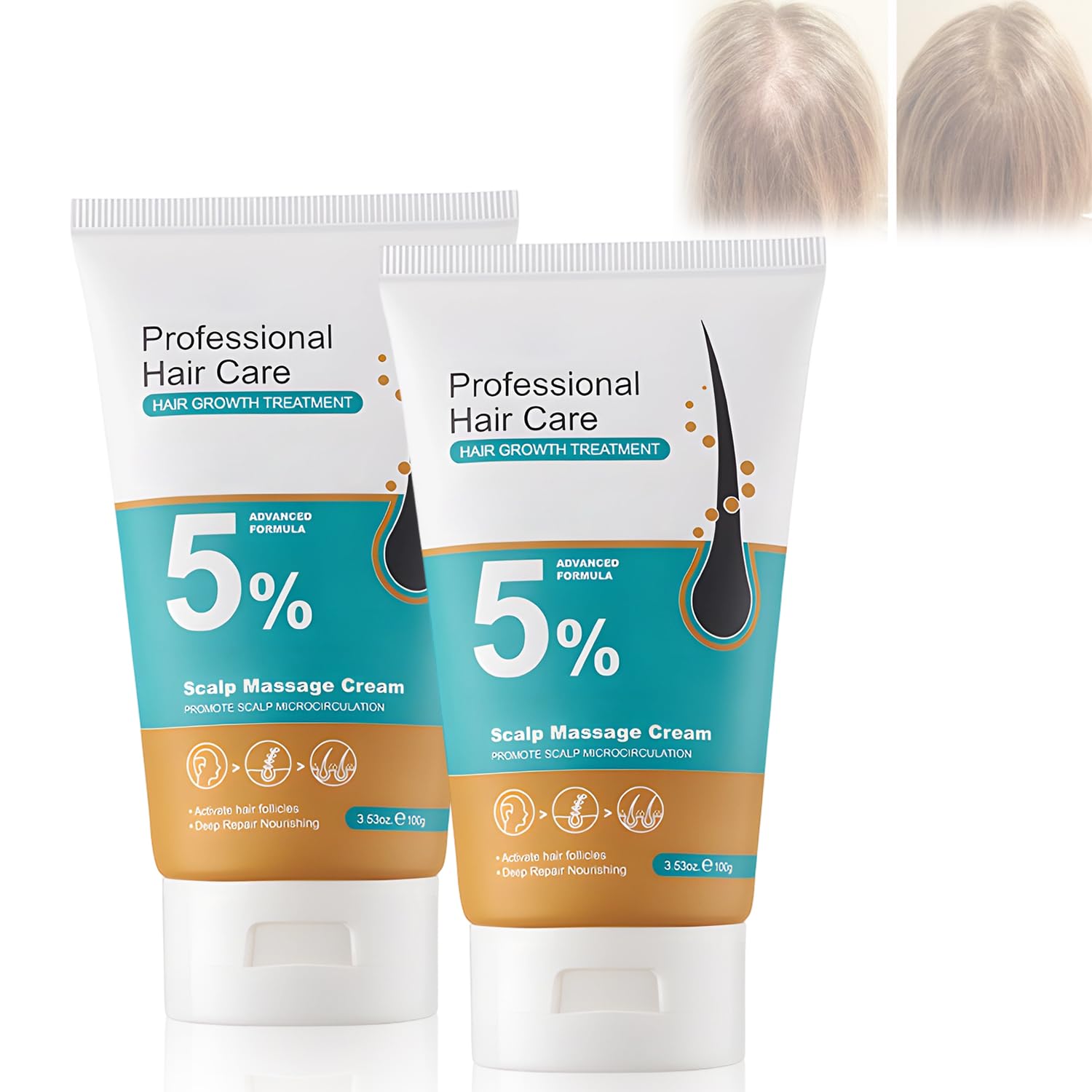 2Pcs 5% Hair Growth Scalp Massage Cream,Professional Hair Care Cream,AntiHair Loss with Rosemary Biotin for Men & Women,Fast Re