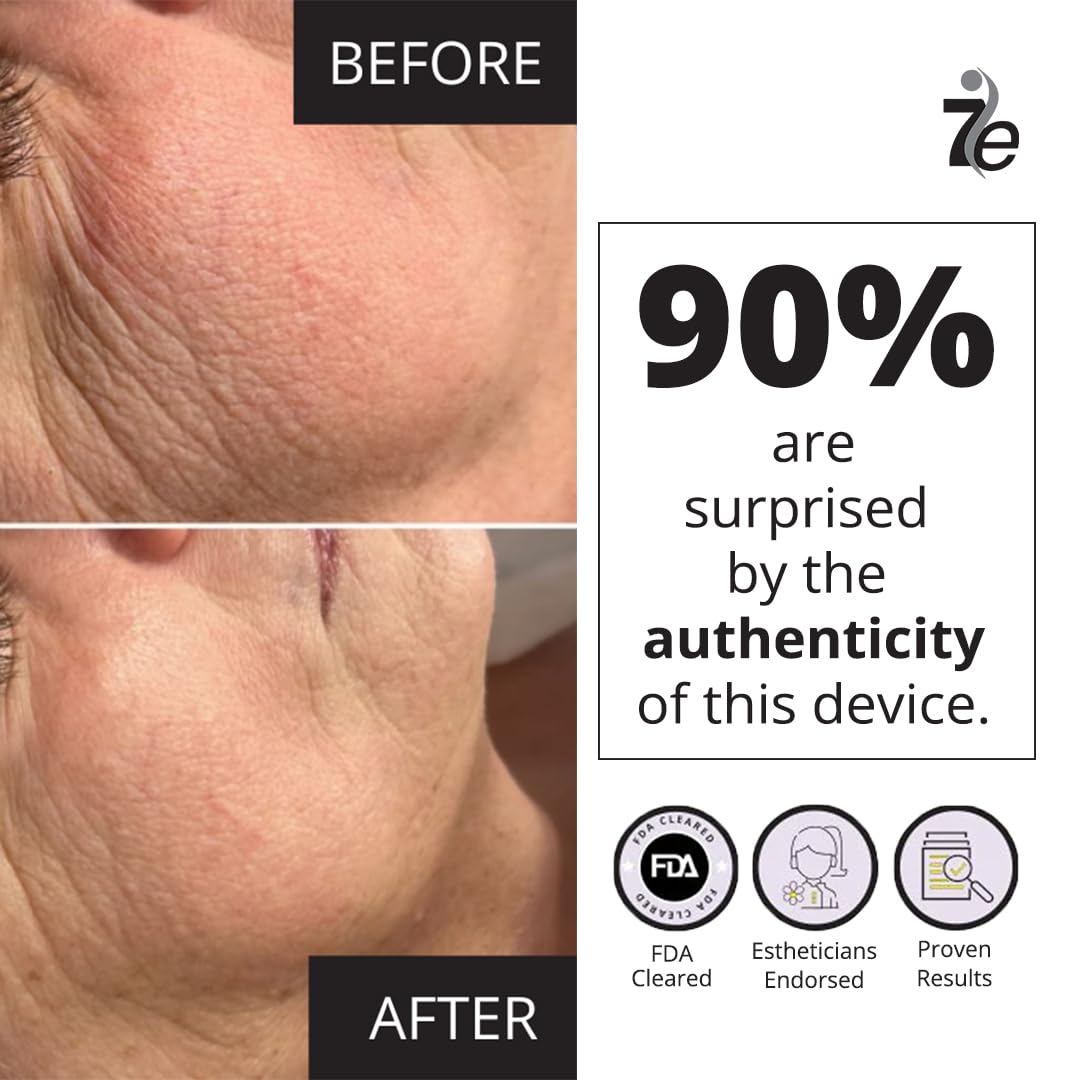 7E Wellness Myolift Mini Microcurrent Facial Device - Non-Invasive Face Lift, Facial Skin Care Products For Anti Aging, Skin Tig