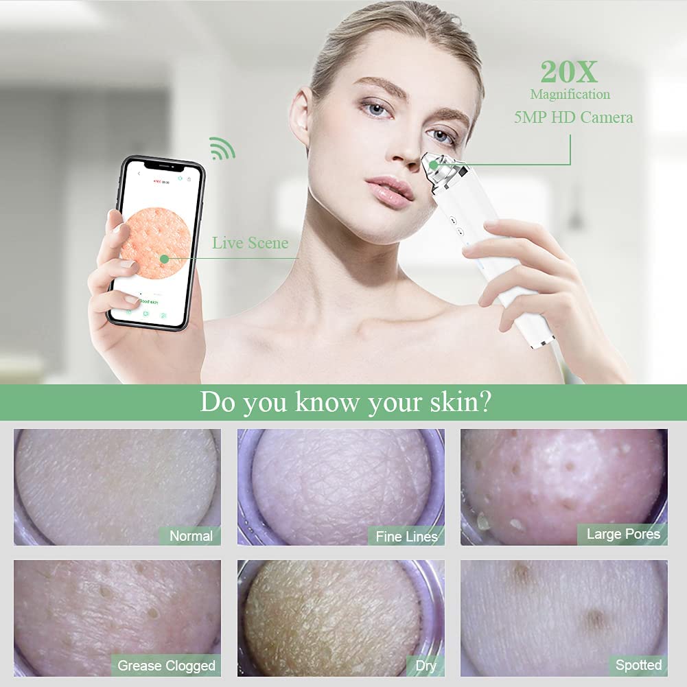 Prabensei Blackhead Remover Pore Vacuum, WiFi Facial Cleanser with HD Camera, 1 Count, White, ABS, Model 1, 6 Suction Heads