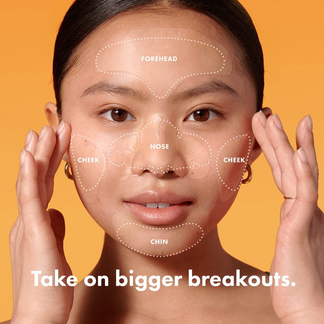 Mighty Patch Face Patch From Hero Cosmetics - Xl Hydrocolloid Face Mask For Acne, 5 Large Pimple Patches For Zit Breakouts On No