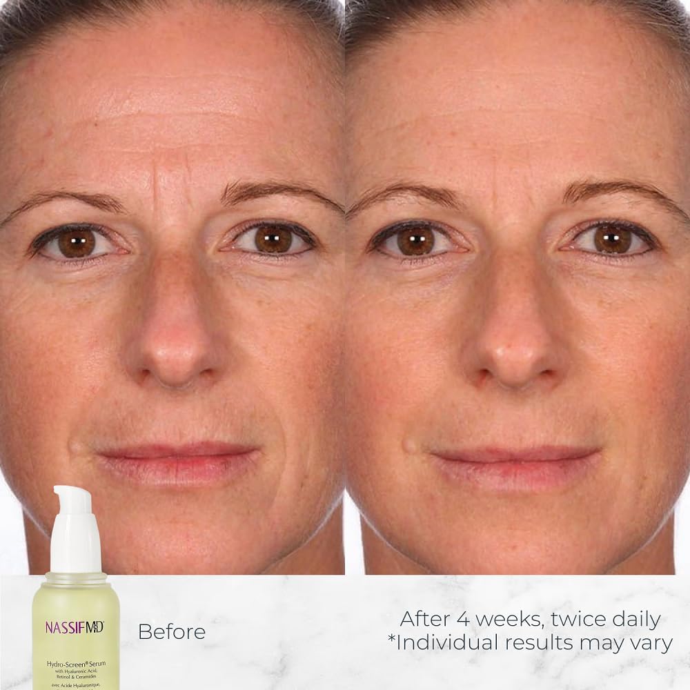 NassifMD Hydro-Screen Hydrating Serum with Hyaluronic Acid & Ceramides - Lightweight, Fast-Absorbing Formula for Smooth, Plump,