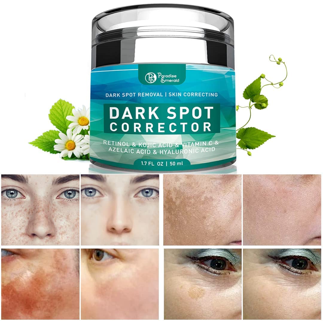 Paradise Emerald Dark Spot Remover For Face, Hyperpigmentation Treatment, Melasma, Freckle, Sun Spots Removal For All Skin Types
