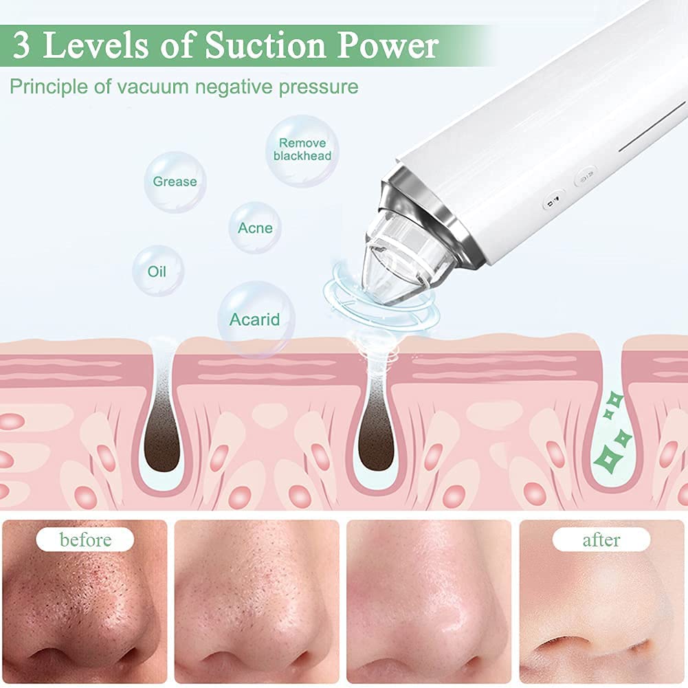 Prabensei Blackhead Remover Pore Vacuum, WiFi Facial Cleanser with HD Camera, 1 Count, White, ABS, Model 1, 6 Suction Heads