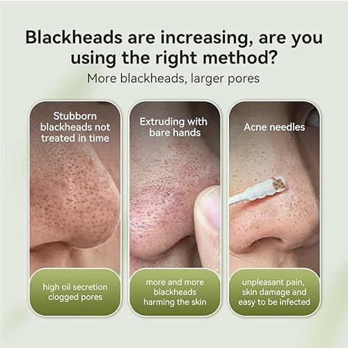 LANBENA Blackhead Nose Strips, 60pcs Deep Cleansing Peel-Off Mask, 1.03 Oz, Ivory