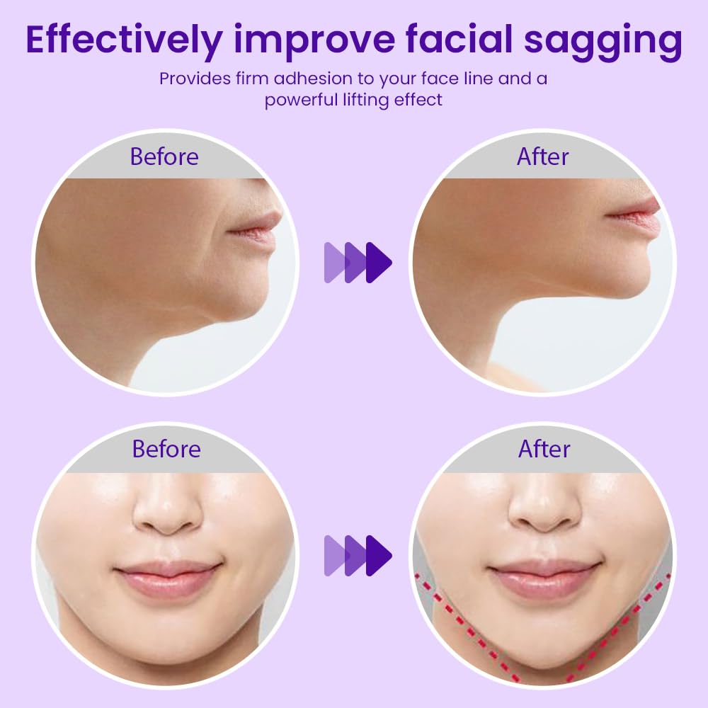 Kaely 6Pcs V Line Lifting Mask,V Line Chin Strap,V Shaped Contouring Face Mask With Collagen,Hydrating Anti-Aging,Red-Small Size