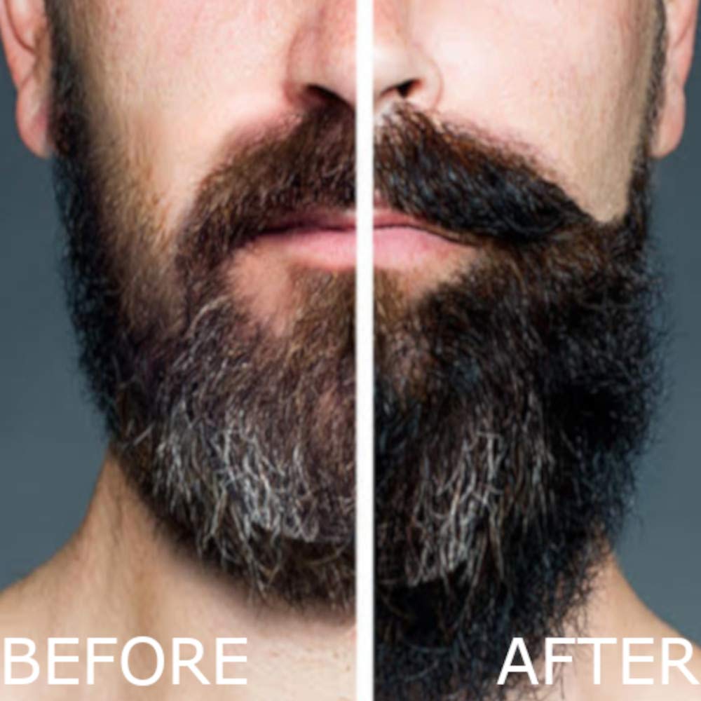 Arlo'S Pro-Growth 2-In-1 Beard Wash And Conditioner - Vanilla Sandalwood With Menthol 12 Oz