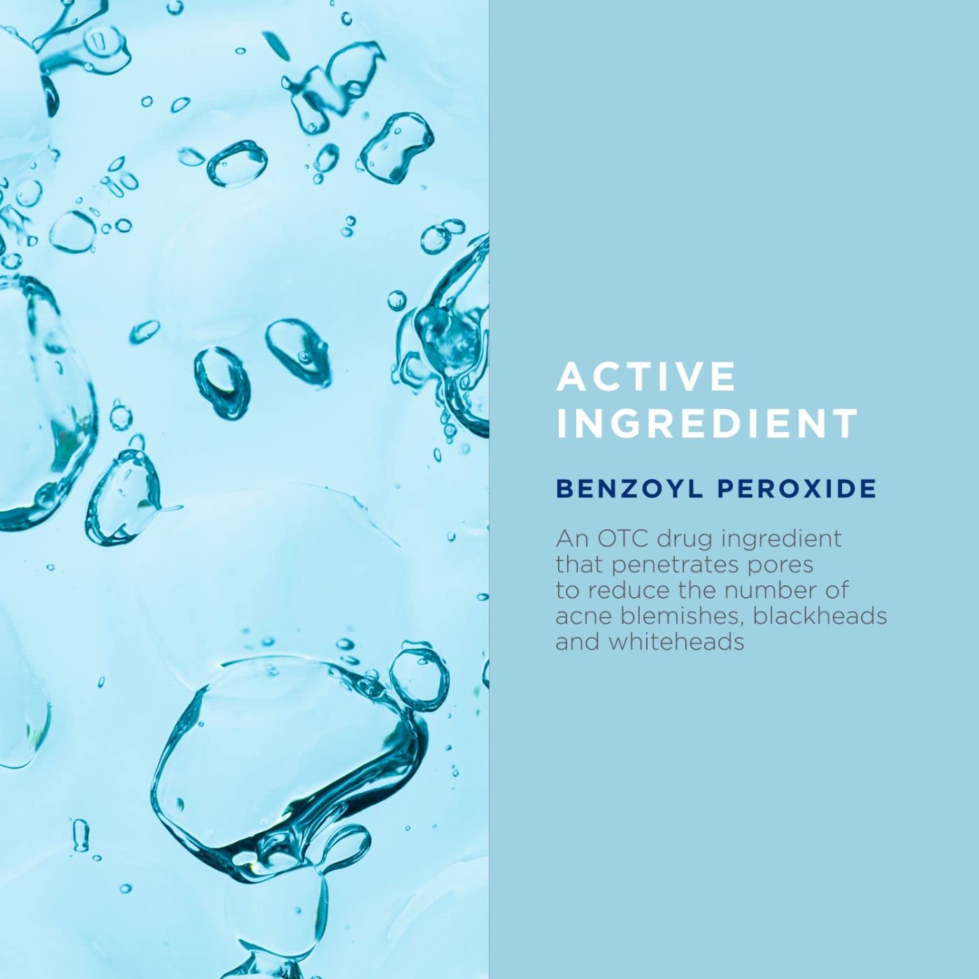 Image Skincare, Clear Cell Clarifying Acne Lotion Treatment, With Benzoyl Peroxide, Treats Existing Acne Blemishes While Prevent