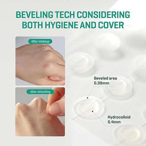 Some By Mi 30 Days Miracle Clear Spot Patch  18Counts, 2 Size (10Mm 9Counts, 12Mm 9Counts)  Invisible Spot Sticker For Sensitive
