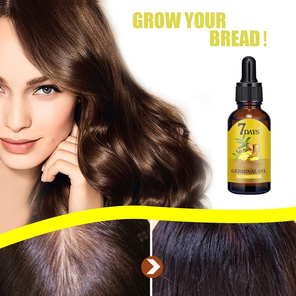 Ginger Hair Growth Serum for Scalp Massage, Hair Follicle Treatment, Hair Care - Germinal Essence Conditioner for Regrowth & Los