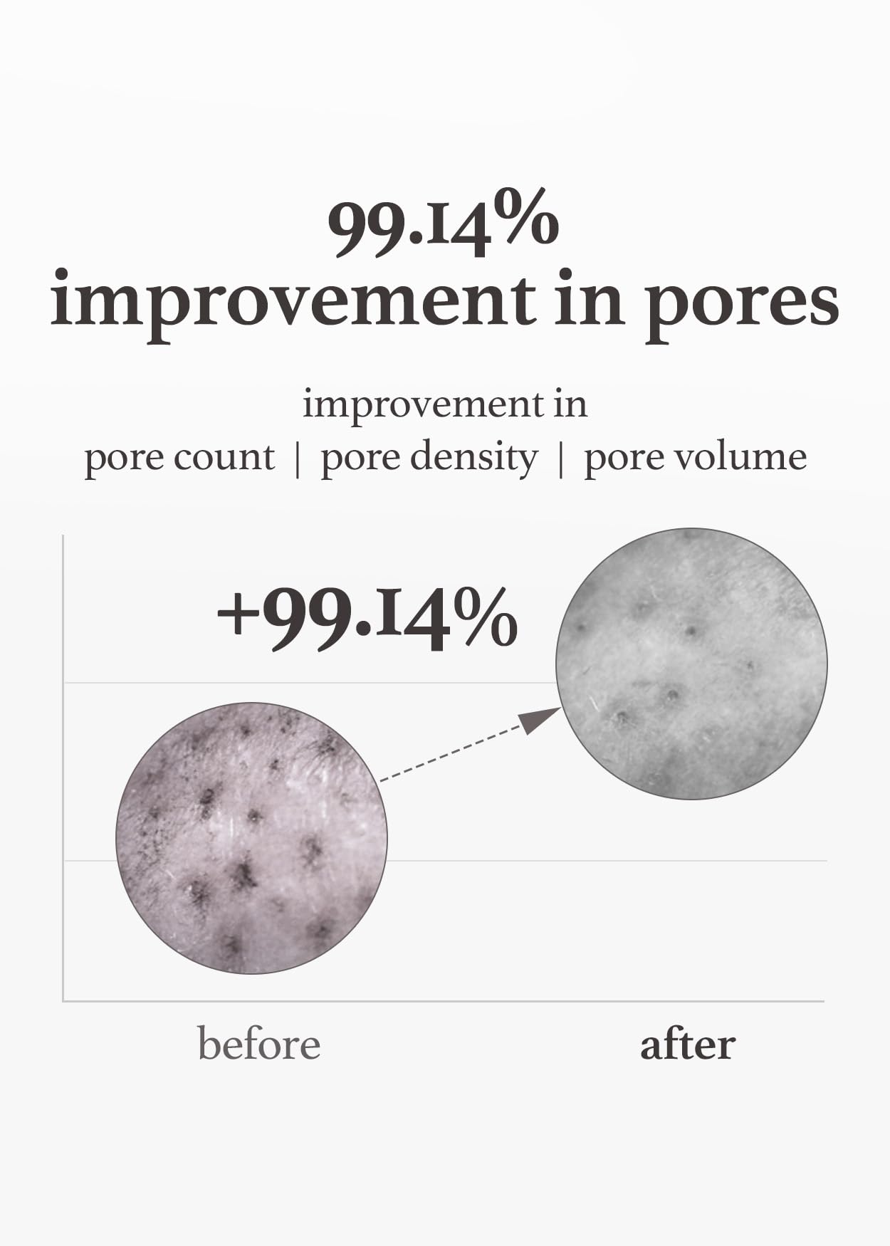 Nooni Korean Cleansing Oil - Snow Aqua 0 Lha Toning Pore Care Korean Facial Oil Cleanser, 6.76 Fl.Oz | Makeup Double Cleansing,