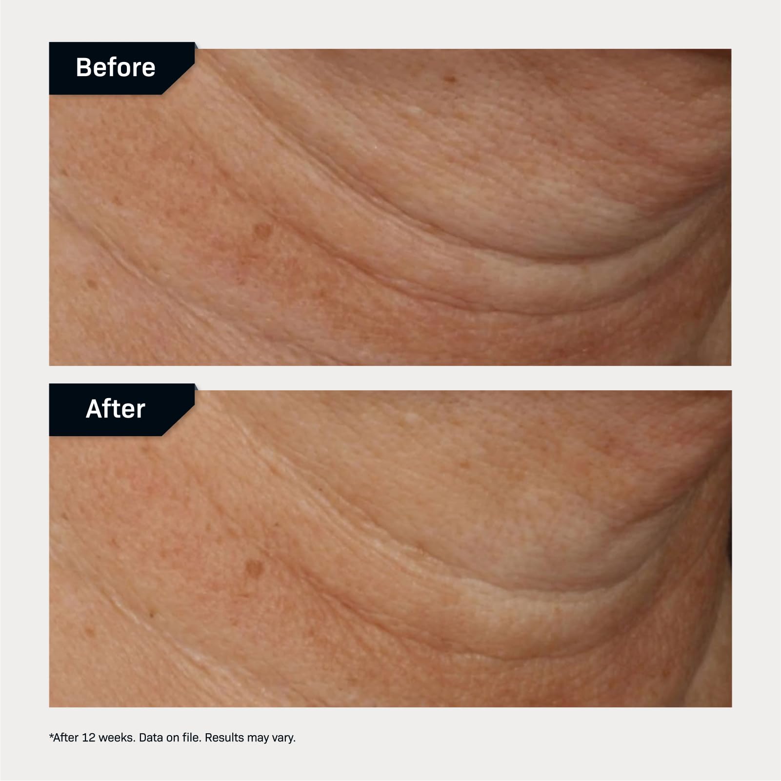 Revision Skincare Nectifirm® Advanced Anti Aging Neck Firming Cream, 1.7 oz, White, Peptides for Fine Lines & Wrinkles