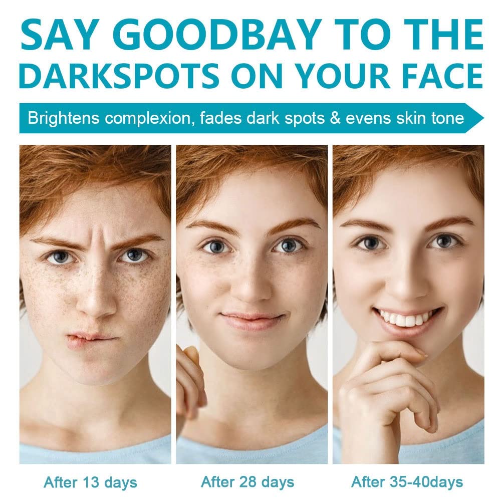 Swetiyou Dark Spot Remover For Face, Fast-Acting Dark Spot Corrector Remover For Face And Body Hyperpigmentation, Fades Melasma,