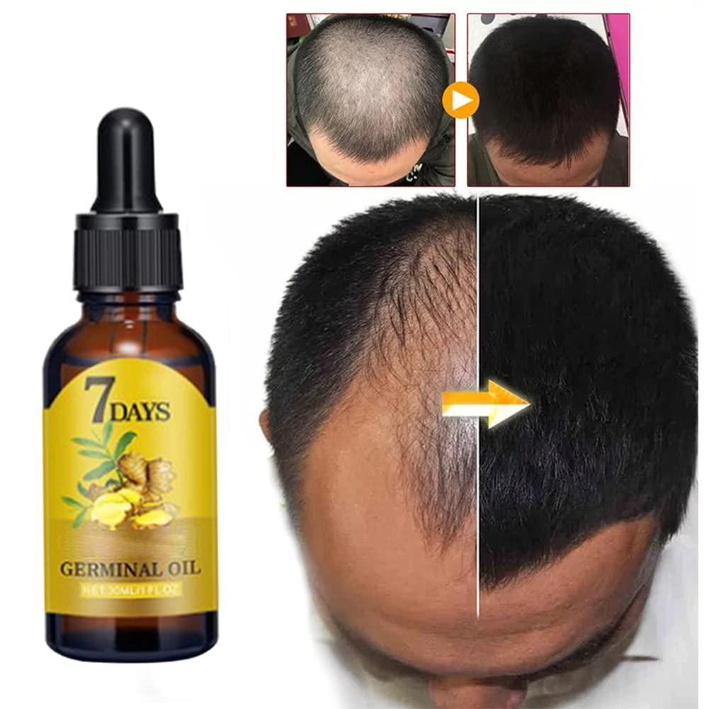 Ginger Hair Growth Serum for Scalp Massage, Hair Follicle Treatment, Hair Care - Germinal Essence Conditioner for Regrowth & Los