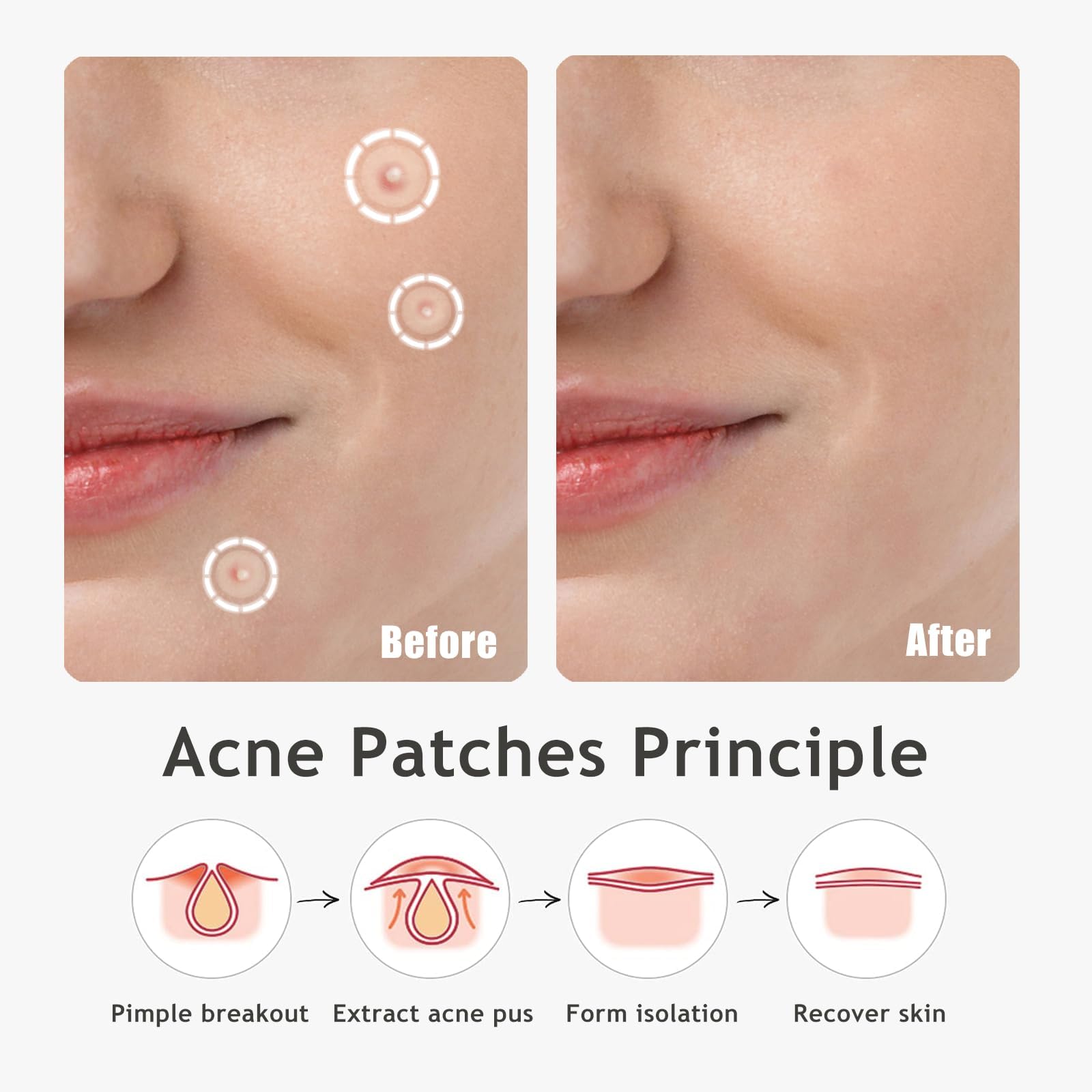 Dazzlook Ultra Pimple Patches - Hydrocolloid Acne Patch For Covering Zits And Blemishes Breakouts Spot Acne Dots Stickers For Fa