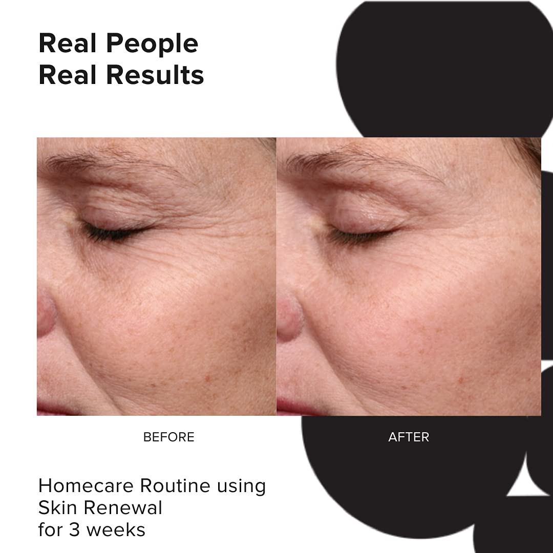 PRIORI Skincare Skin Renewal Cream with Lactic Acid Retexturizing Face Moisturizer for Dark Spots, Fine Lines & Wrinkles, Acne S