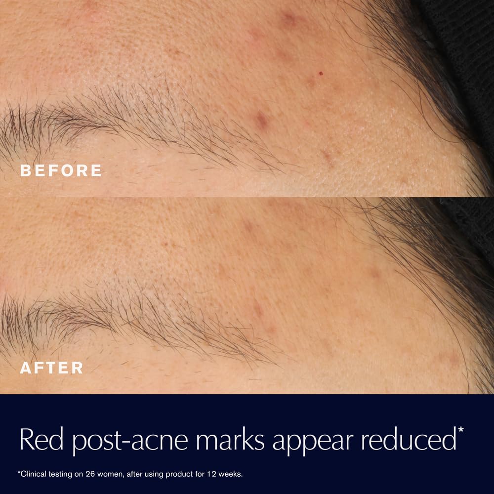Est  E Lauder Advanced Night Repair Rescue Solution With 15% Bifidus Ferment To Reduce Visible Redness, 0.68 Fl Oz
