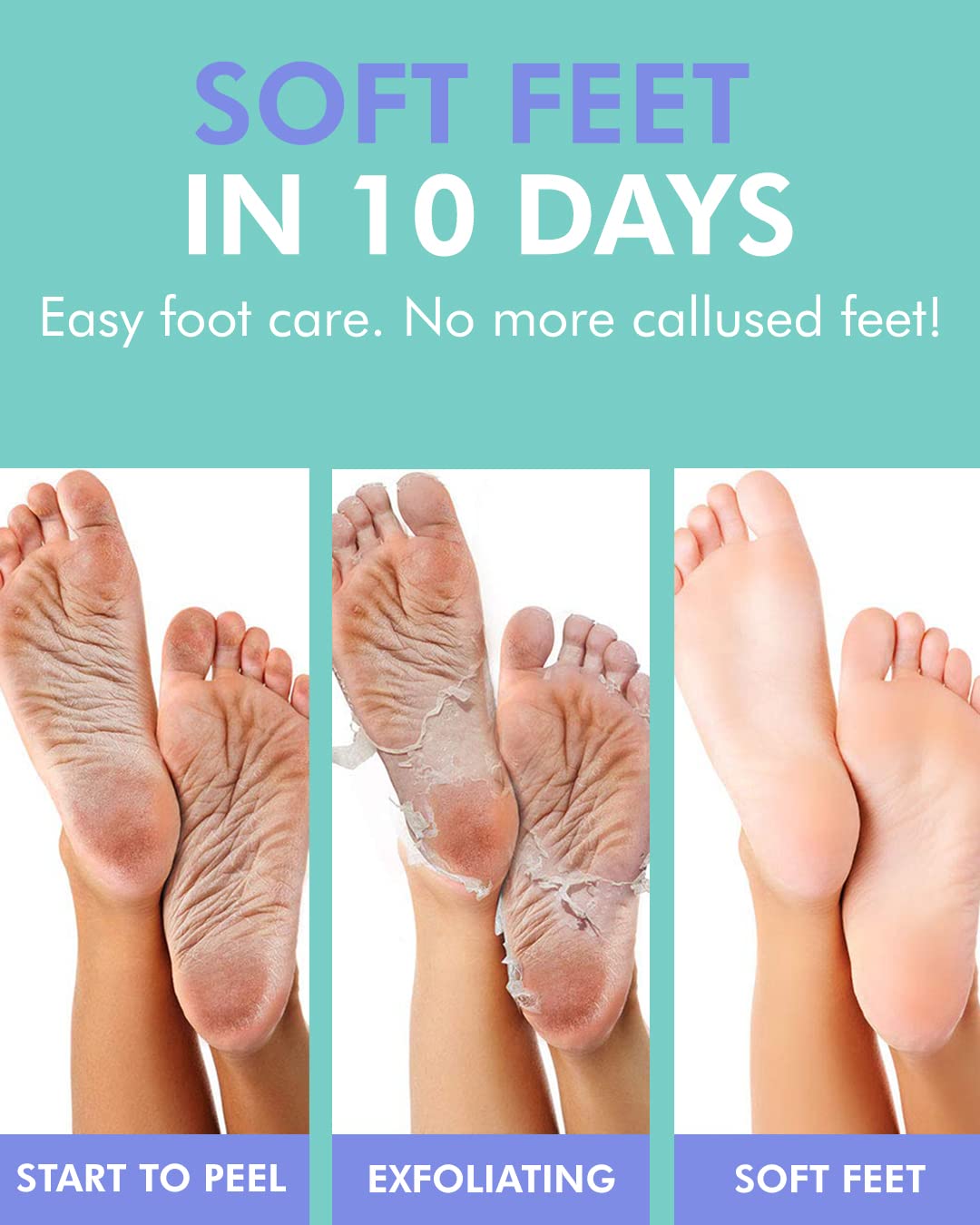 Dermal Korea Foot Peeling Mask 2 Pack For Dry Foot And Cracked Heel & Callus With Aloe Vera And Collagen - Exfoliating Peel Mask