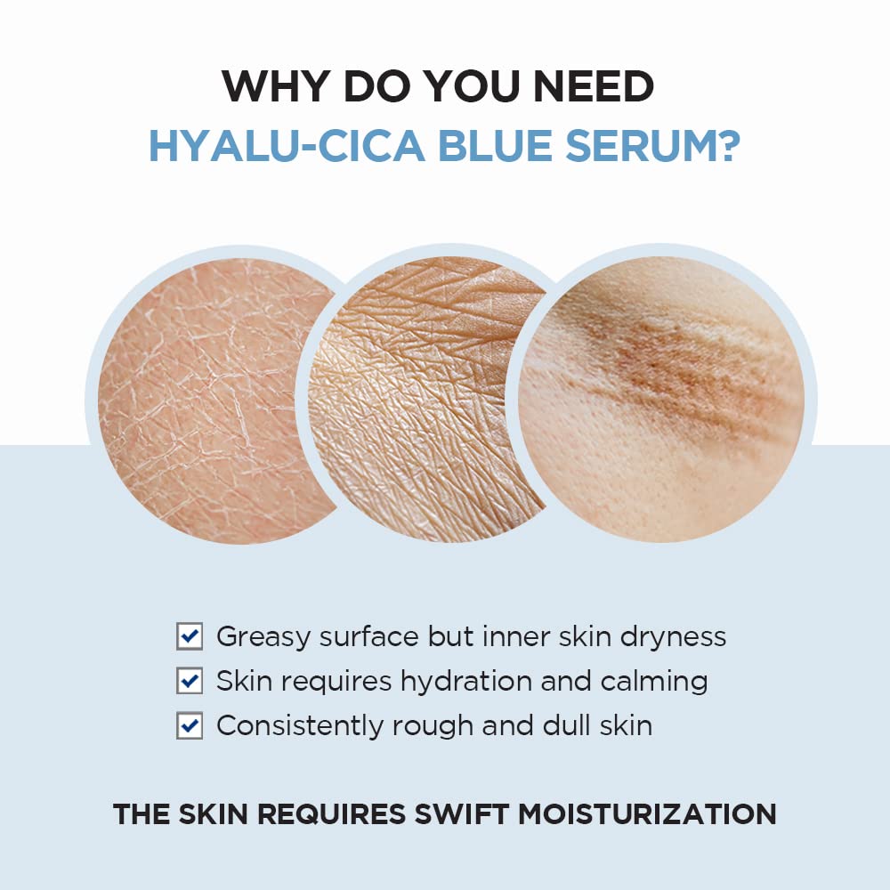 SKIN1004 Hyalu-CICA Blue Serum 1.69 fl.oz, 50ml, 5 Layer Hyaluronic Acid Cica Niacinamide, Hydrating and Refreshing Multi-Care S