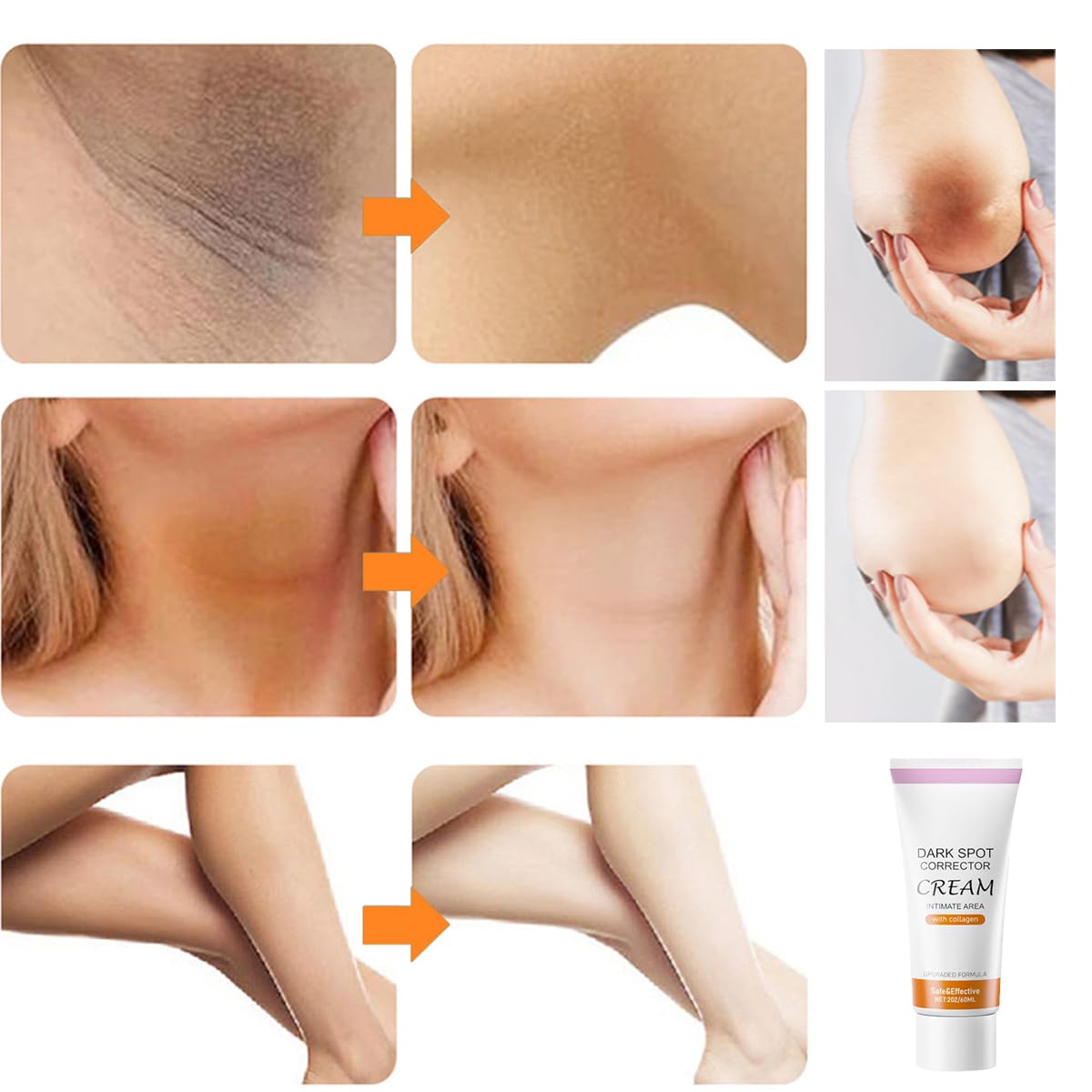 Dark Spot Corrector Cream,Dark Spot Remover For Face And Body With Collagen,Niacinamide,Intimate Areas And Bleaching,Neck,Undera